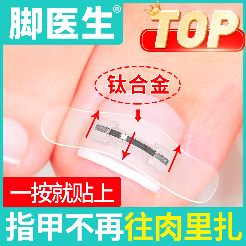 脚医生甲沟嵌甲矫正器炎正甲贴贴片脚趾指甲往肉里长专用指甲刀剪