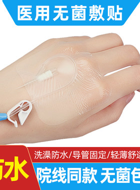 静脉留置针固定贴长运
