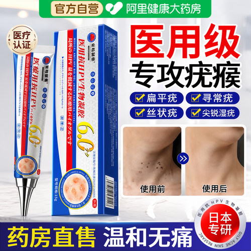 日本医用去疣瘊小肉粒扁平疣药膏