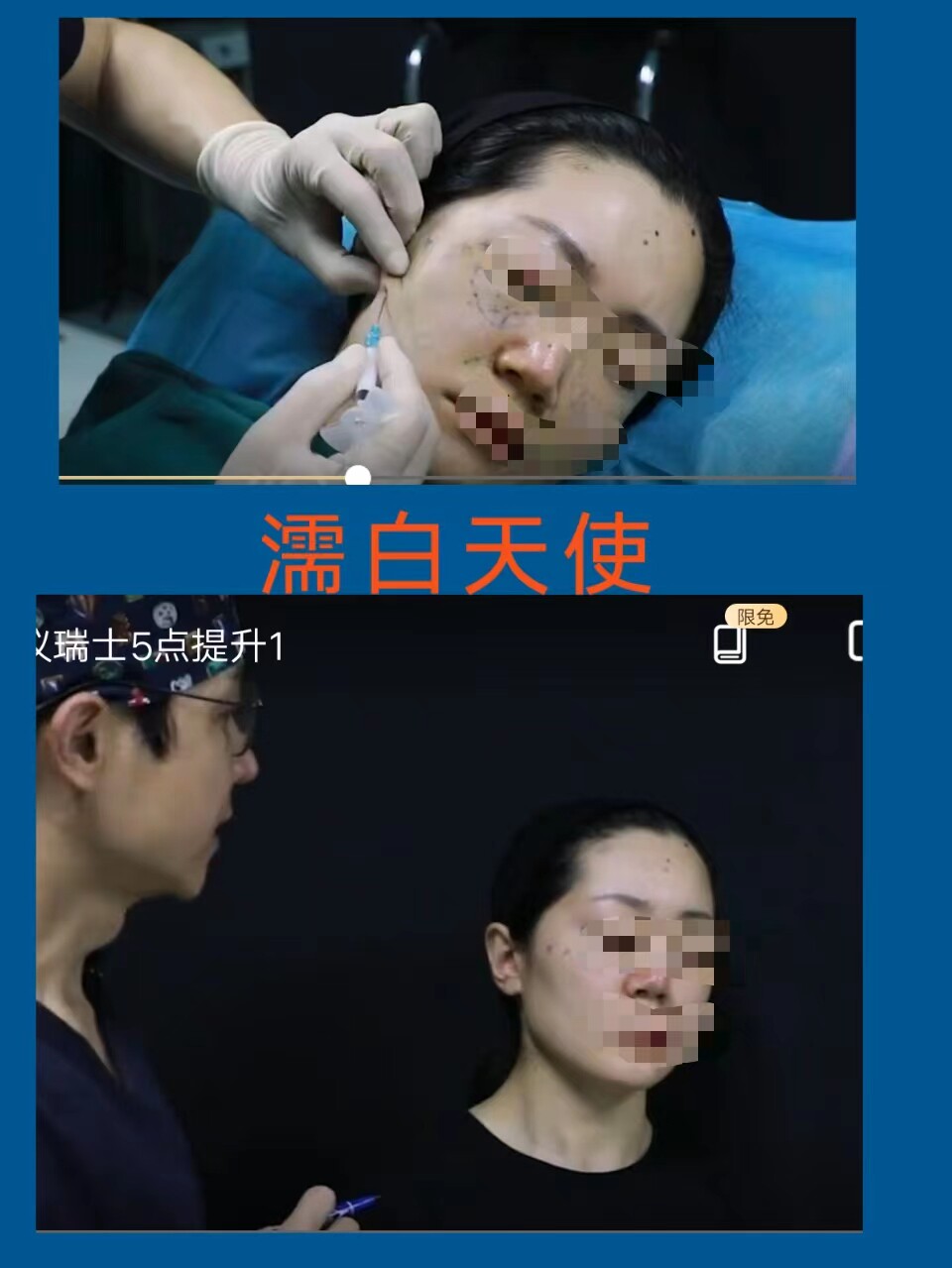 濡白天使面部填充下颌缘瑞士5点提升高清学习3节教程