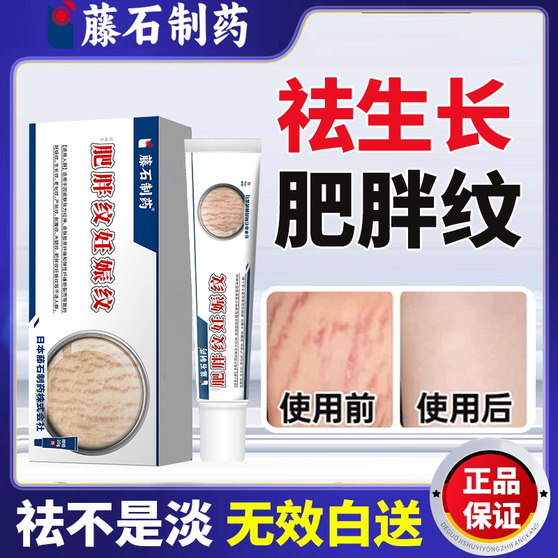去除肥胖纹生长纹消除大腿专用修妊娠纹护理