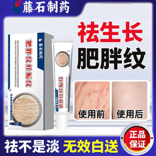 去除肥胖纹生长纹消除大腿专用修复霜青少年学生精油修复KT