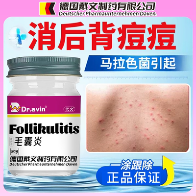 背上前胸后背长痘痘毛囊炎除螨祛痘止痒马拉色菌毛囊炎专用膏KT