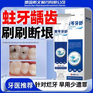 蛀牙龋齿修复虫牙牙菌斑黑线去除牙洞清理牙虫的牙膏KT