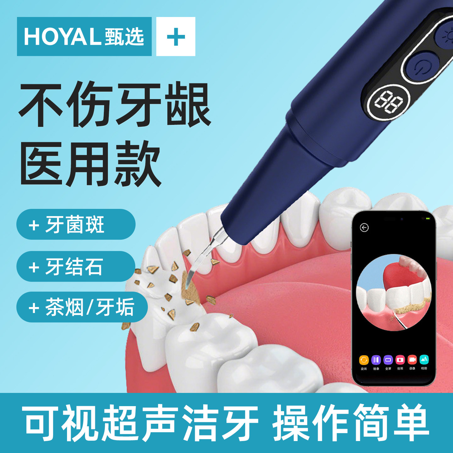 超声波洗牙器去除牙结石神器家用清洁牙齿机洁牙仪去冲牙石牙垢洗