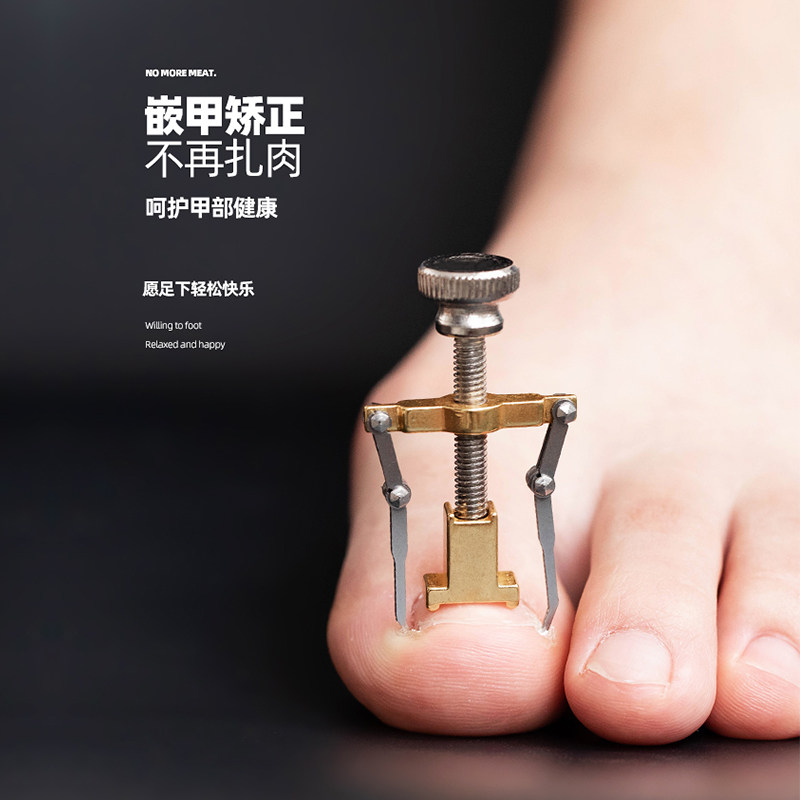 甲沟嵌甲矫正器修正脚指甲长肉里脚趾甲纠正内嵌勾指沟炎神器专用