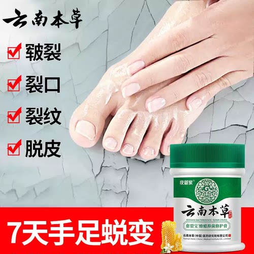 皮管家云南本草手足干燥防裂润手霜男女护手霜裂可宁愈裂膏防开裂
