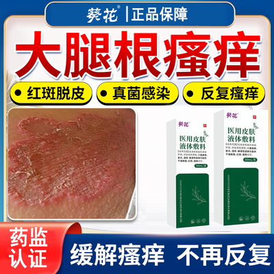 医用皮肤敷料股癣湿疹专用除湿皮肤瘙痒皮炎干燥脱屑痤疮止痒膏lb