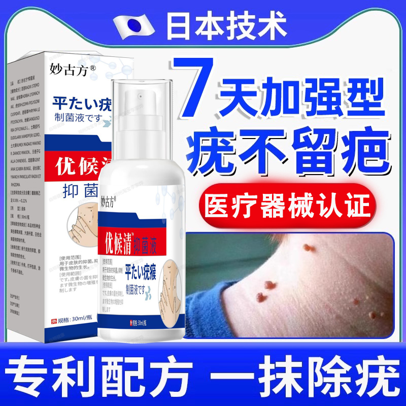妙古方优侯清抑菌液疣瘊草本萃取温和颈部脖子上长肉粒疙瘩正品an