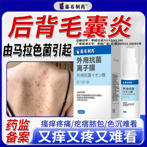 后背长痘痘毛囊炎喷雾清爽不黏腻