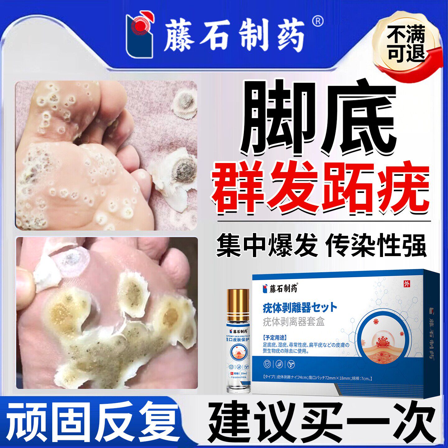 跖疣病毒疣HPV去除非连根拔人凝胶医用脚底长石疣药防复发膏JI