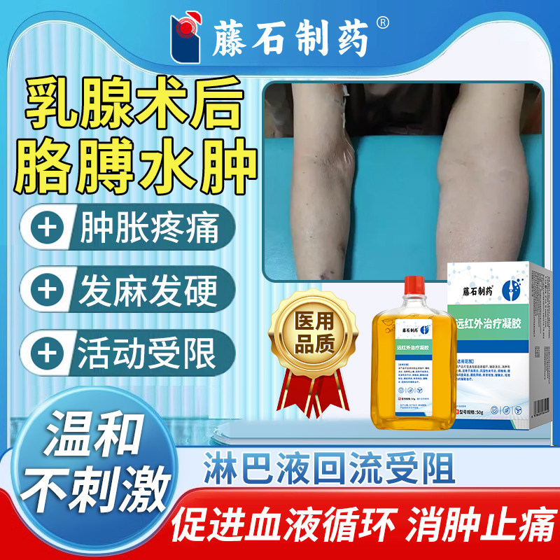 乳腺术后上肢手臂胳膊淋巴水肿淋巴管堵塞受阻搭压力袖套弹力袖SA