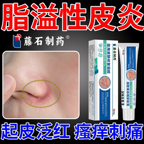 鼻翼两侧泛红脂溢性皮炎面部修复脸上鼻子发红干燥起皮药房同售CA