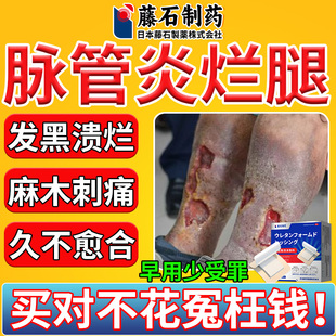 脉管炎老烂腿专用静脉曲张小腿血栓烂足伤口愈合药房同款膏CA