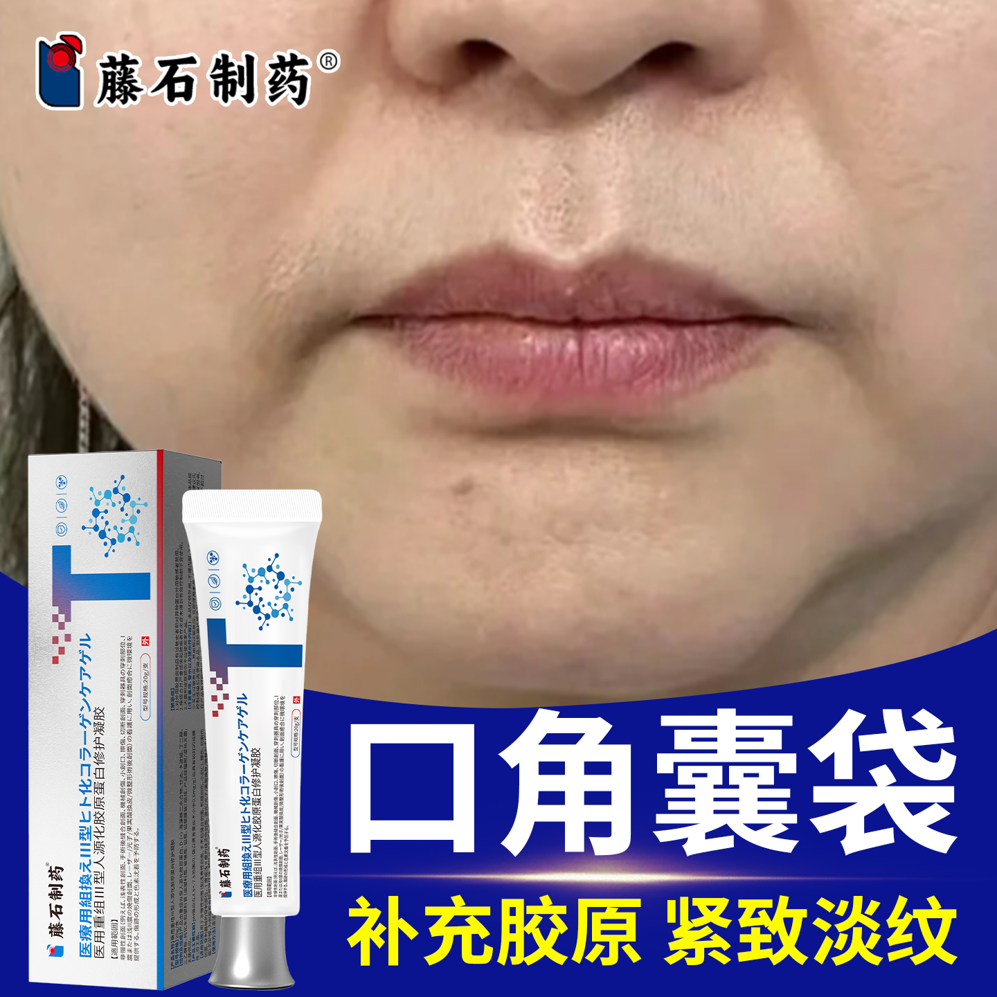 去口角囊袋嘴角下垂木偶纹法令提拉升贴医用级胶原蛋白凝胶N6