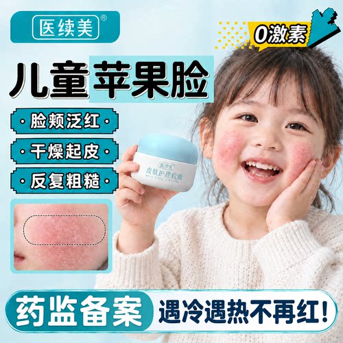 儿童小孩大红脸保湿去红滋润面霜