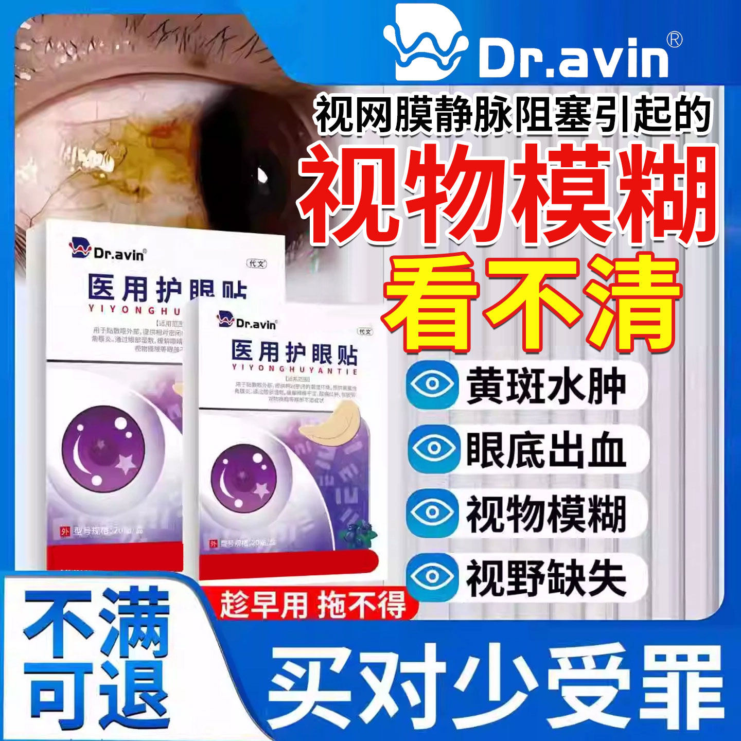 视网膜静脉阻塞眼底黄斑病变出血眼去除睛水肿叶黄素冰敷眼贴CA