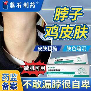 脖子鸡皮肤疙瘩毛囊角化症毛周角化去除脖颈上粗糙颗粒小黑点YI