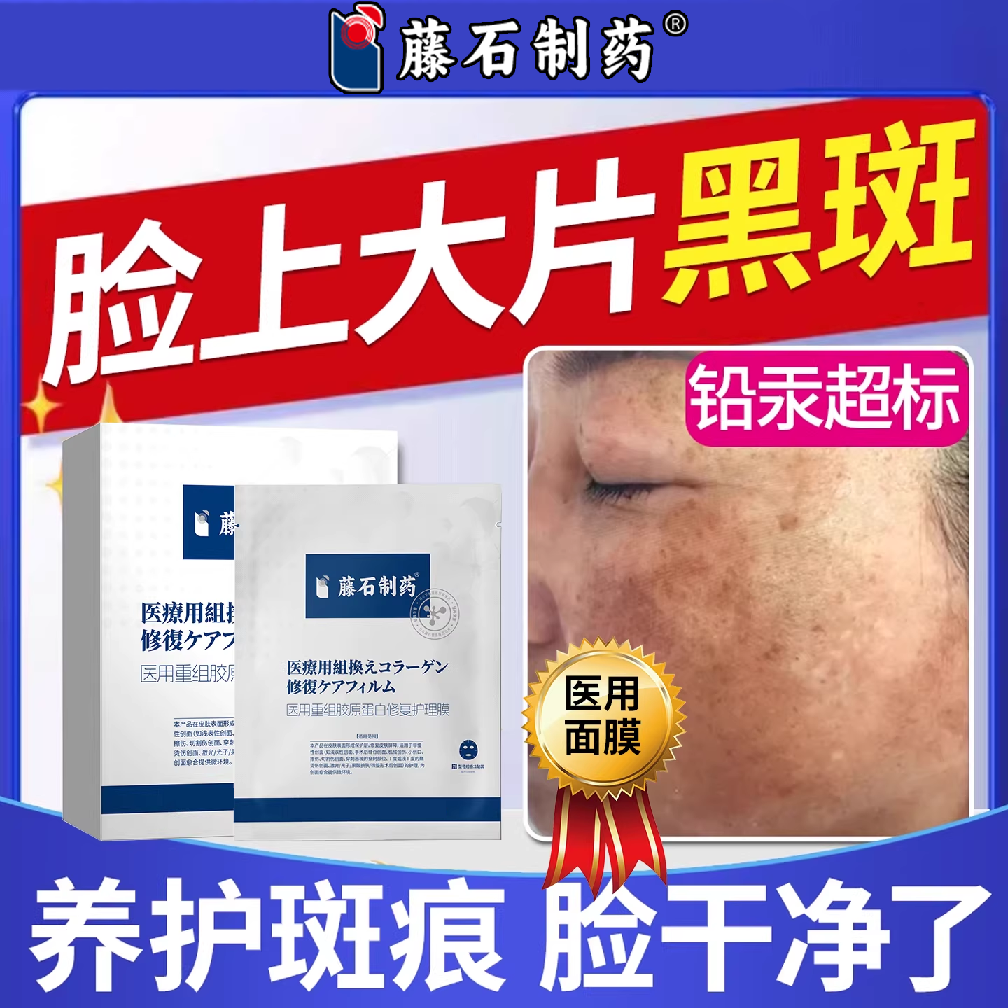药房同售汞斑黑斑美白淡斑面膜黄褐斑去除色斑贴淡化色素中SK