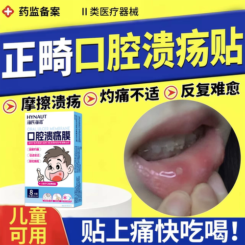 正畸口腔溃疡愈合贴整牙反复防磨嘴隔离止痛带牙套起泡儿童专用YI