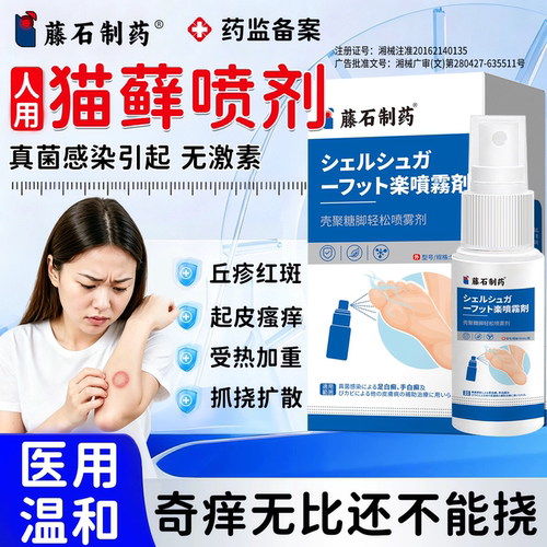 猫藓人用药房同售人得猫藓铜钱藓体癣皮肤病喷雾剂真菌感染瘙痒PG