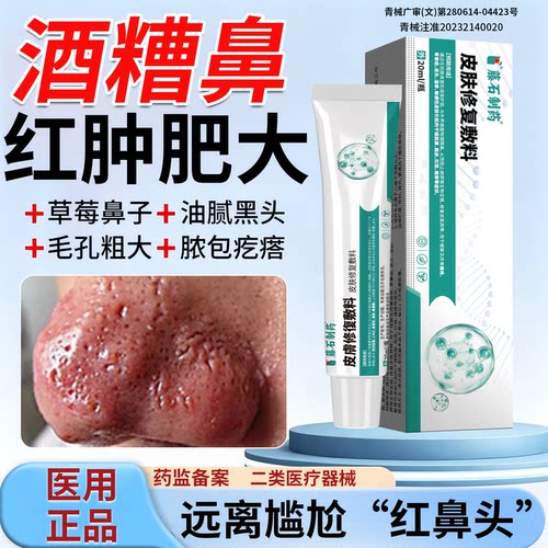 酒糟鼻专用玫瑰痤疮药房同售膏医用级红鼻子草莓鼻鼻头修复除螨ZN