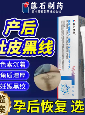 产后肚子黑色素沉淀祛妊娠纹去黑线腹部淡化消除修复疤痕除疤膏VX