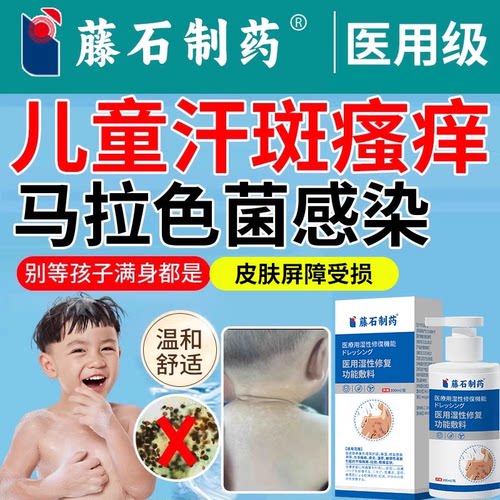 儿童汗斑花斑癣搭沐浴露洗剂专用马拉色菌感染玫瑰糠疹消白斑CA