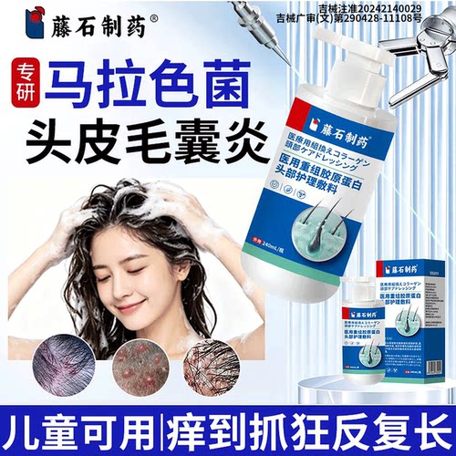 去马拉色菌头皮毛囊炎真菌感染长痘痘头痒有疙瘩痤疮控油洗发水QK