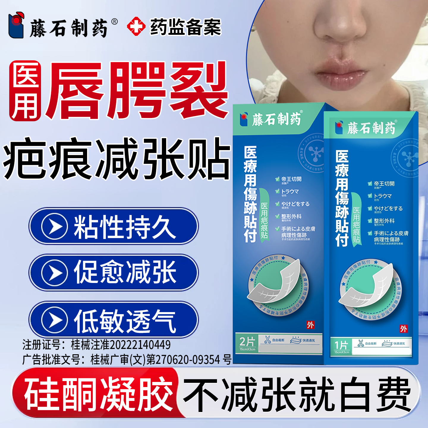 医用硅酮凝胶唇腭裂术后疤痕贴减张贴术后伤口3m减张贴成人儿童P2