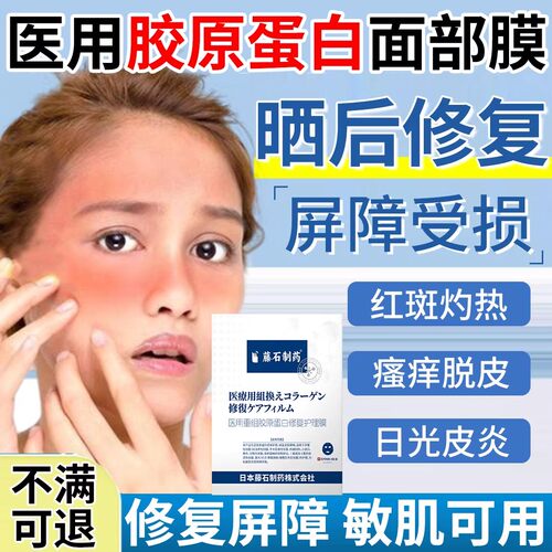 晒后修复急救面膜军训晒伤修复深层补水修护正品舒缓医泛红用级EF
