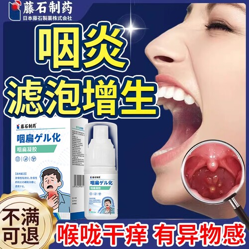滤泡增生咽炎咽喉炎慢性咽炎咽后壁淋巴舌根喉咙发炎异物感喷剂CA