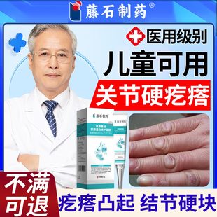 手指关节指节垫软化手上长硬疙瘩指状疣粗糙瘙痒关节增厚肿茧样SK