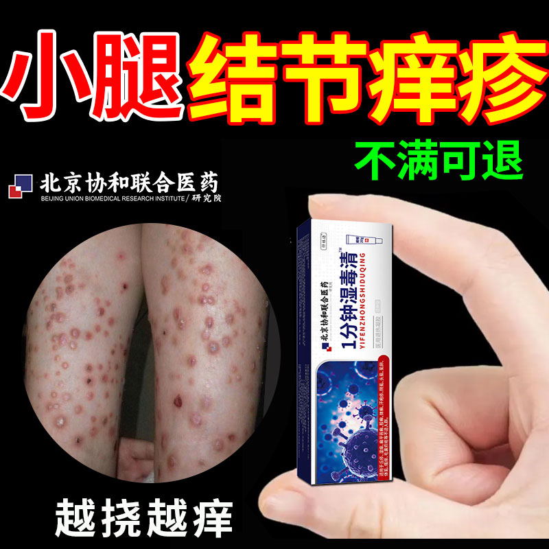 小腿结节性痒疹特非治疗效顽固硬疙瘩皮肤病红斑疙瘩可搭膏药贴qk