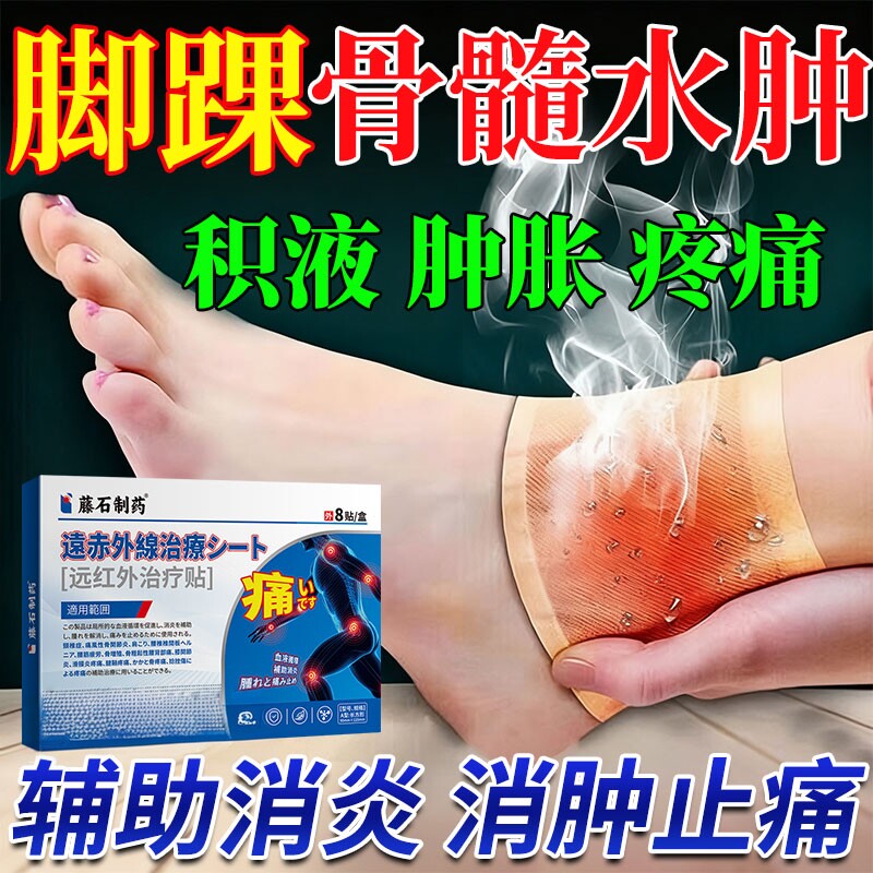 脚踝骨髓水肿关节积液韧带损伤脚腕疼痛扭伤滑膜炎膏药热敷贴CA