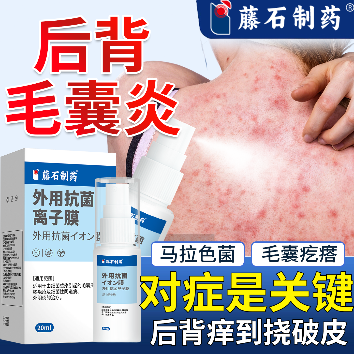 前胸后背长痘痘毛囊炎喷剂马拉色菌药房同售膏手臂长疙瘩瘙痒N6