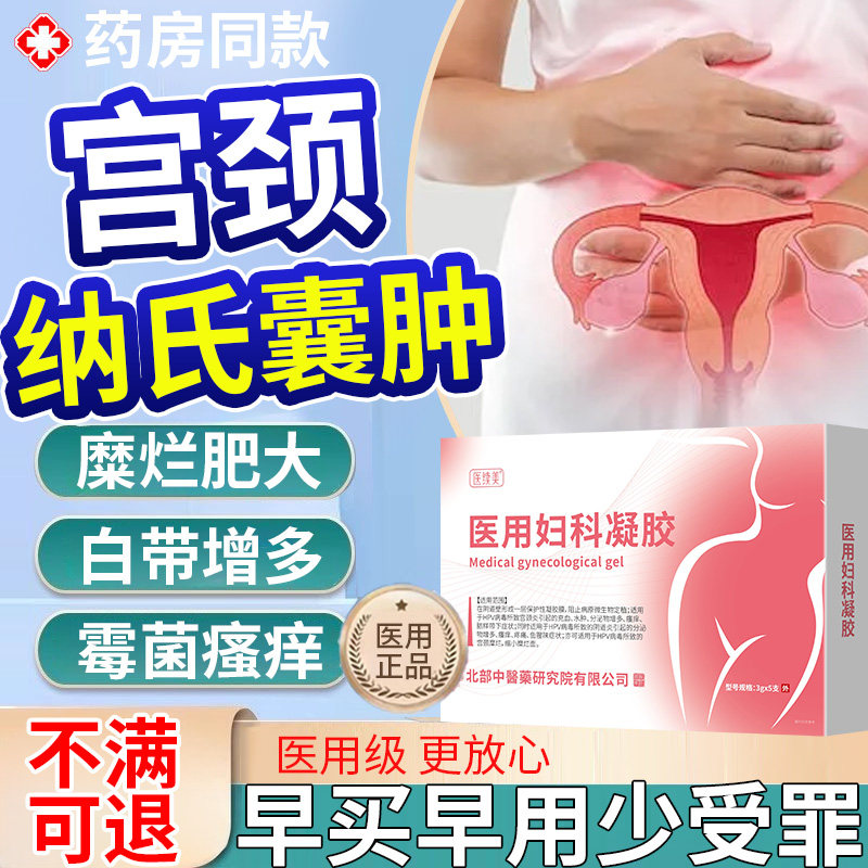 宫颈肥大纳氏囊肿药房同售膏卵巢阴道炎症子宫内膜息肉糜烂专用SK