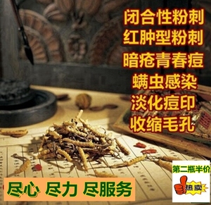 祛封闭性闭合闭口粉刺白头去黑头红肿痘痘痤疮暗疮痘印螨虫温和版