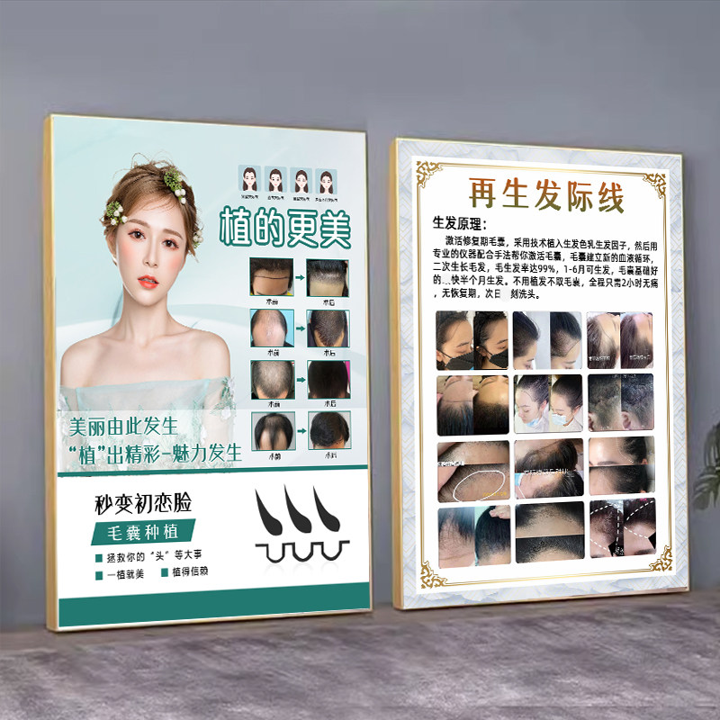 植发海报生发育发广告再生发际线挂画养发馆装饰画种植眉毛图片KT