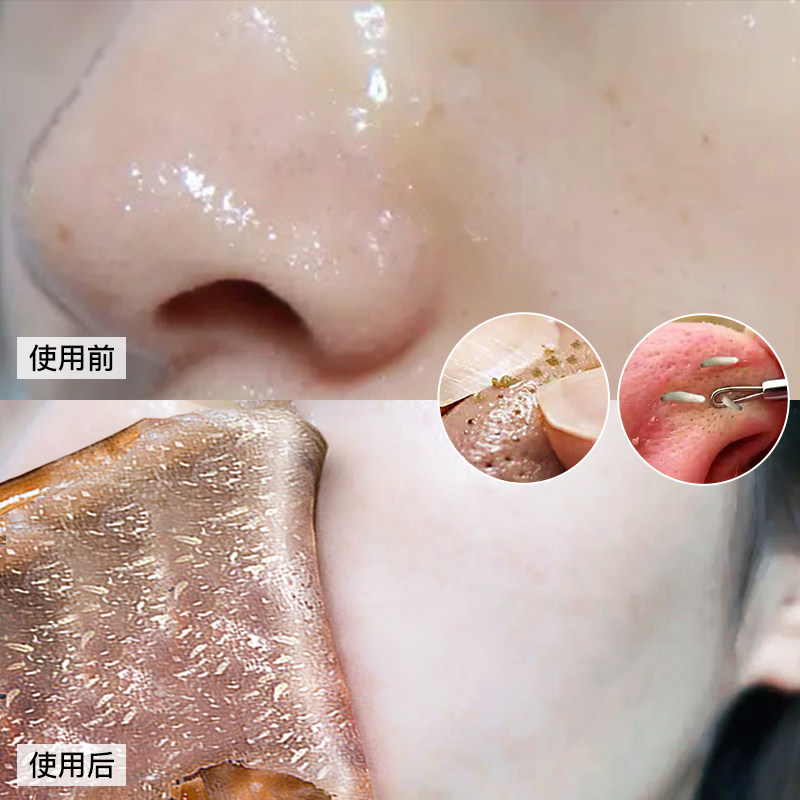 【2020斗音同款买一送一】撕出脏东西 清洁毛孔 撕拉面部护理套装