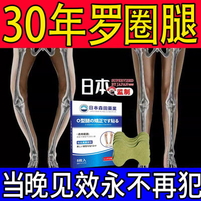 小腿外翻xo型腿矫正贴鞋垫直腿神器罗圈腿足外翻纠正腿型儿童专用