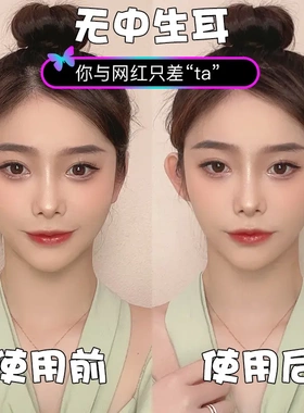 精灵耳贴隐形立耳贴招风耳固定帖显脸拍照矫正支撑器硅胶