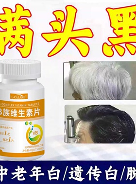 澳博多维素其多种维生素片黑发少中老年白发掉发头发稀氏呵护毛囊