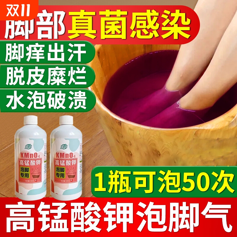 脚气止痒脱皮杀菌【销量No.I】
