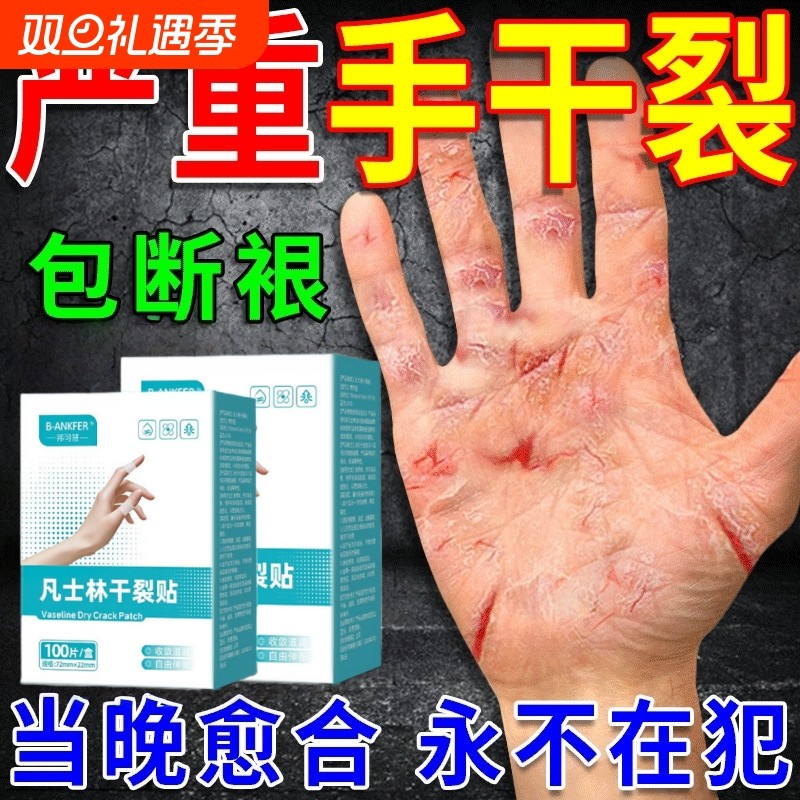 干裂贴手脚贴手足皲裂贴手指裂口贴脚后跟防裂贴胶布芦荟修复手部