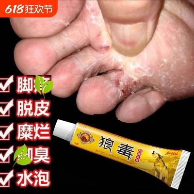 狼毒软膏正品抑菌奇草乳膏去气脚专用水泡皮肤止痒膏脚丫子痒烂脚