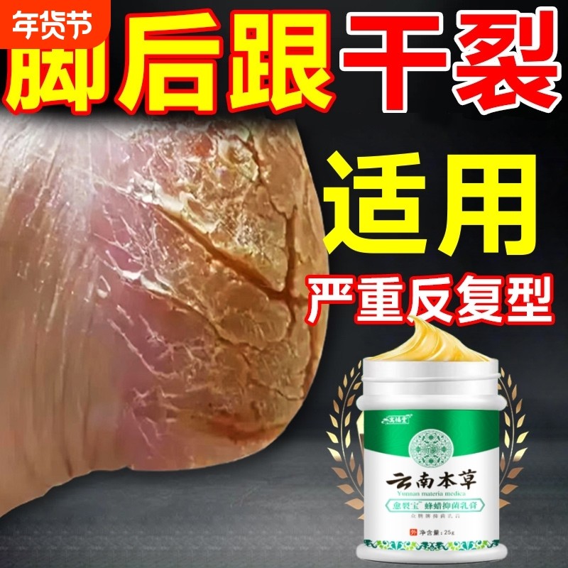 脚后跟干裂防脚裂手指裂口龟裂干燥足底起皮皴裂马油膏身体护理乳,洗护清洁剂/卫生巾/纸/香薰,身体乳液,淘宝优惠券,粉丝福利购,淘宝优惠卷