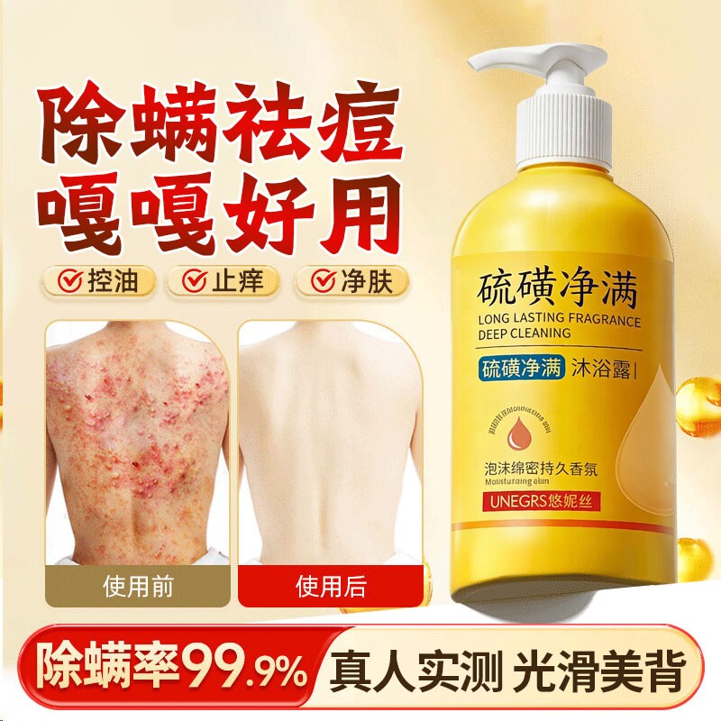 硫磺除螨沐浴露皮肤瘙痒液体香皂成人后背止痒祛痘女男士持久留香