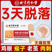 北京同仁堂鸡眼贴药膏贴脚钉祛除鸡茧老茧扁平疣趾疣肉刺瘊子正品