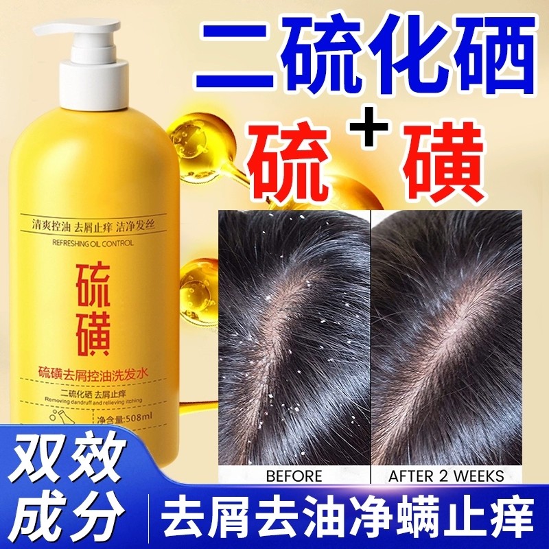 二硫化硒硫磺洗发水洗头膏毛囊去屑止痒蓬松沐浴露头屑洗护氨基酸